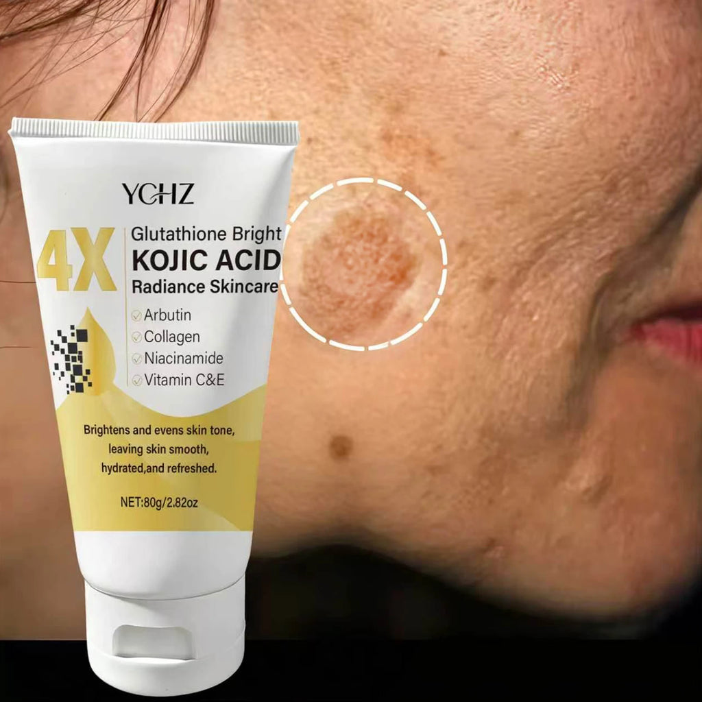 Kojic Acid Face Cream Evens Out Skin Tone, Eliminates Dark Spots and Dullness