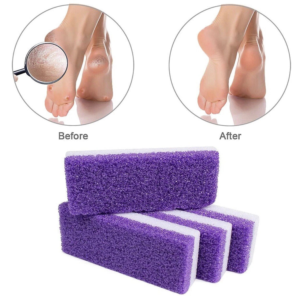 Premium Foot Care Set (2 Pcs): Natural Pumice Stone & Dual-Sided Foot File
